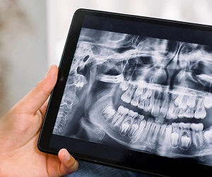 image-xrays